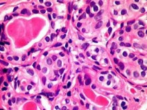 Descoberta imunol�gica pode tratar todos os tipos de c�ncer