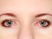 Coronav�rus pode causar conjuntivite