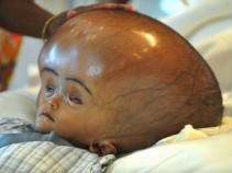 Conhe�a agora 10 aberra��es extremamente bizarras