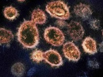 M�dicos dos EUA afastam outro mito do coronav�rus