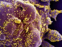 Nos EUA, o coronav�rus est� matando desproporcionalmente pessoas negras