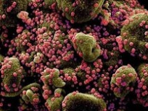 O que faz o coronav�rus t�o mortal