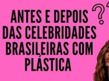 Antes e depois das Celebridades Brasileiras com Pl�stica.