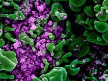 O ataque do coronavrus ao sistema imunolgico  semelhante ao HIV